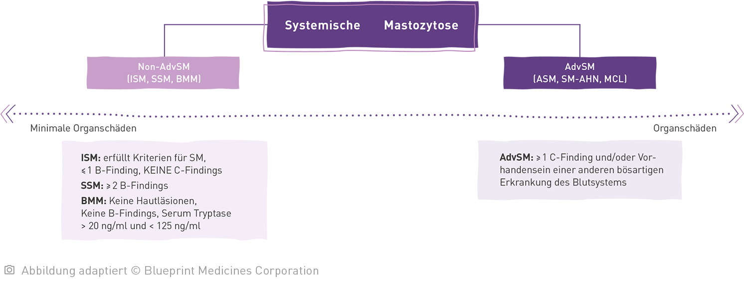 Baumdiagramm von der Systemischen Mastozytose unterteilt in Non-AdvSM und AdvSM