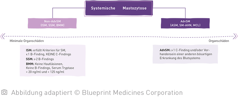Baumdiagramm von der Systemischen Mastozytose unterteilt in Non-AdvSM und AdvSM