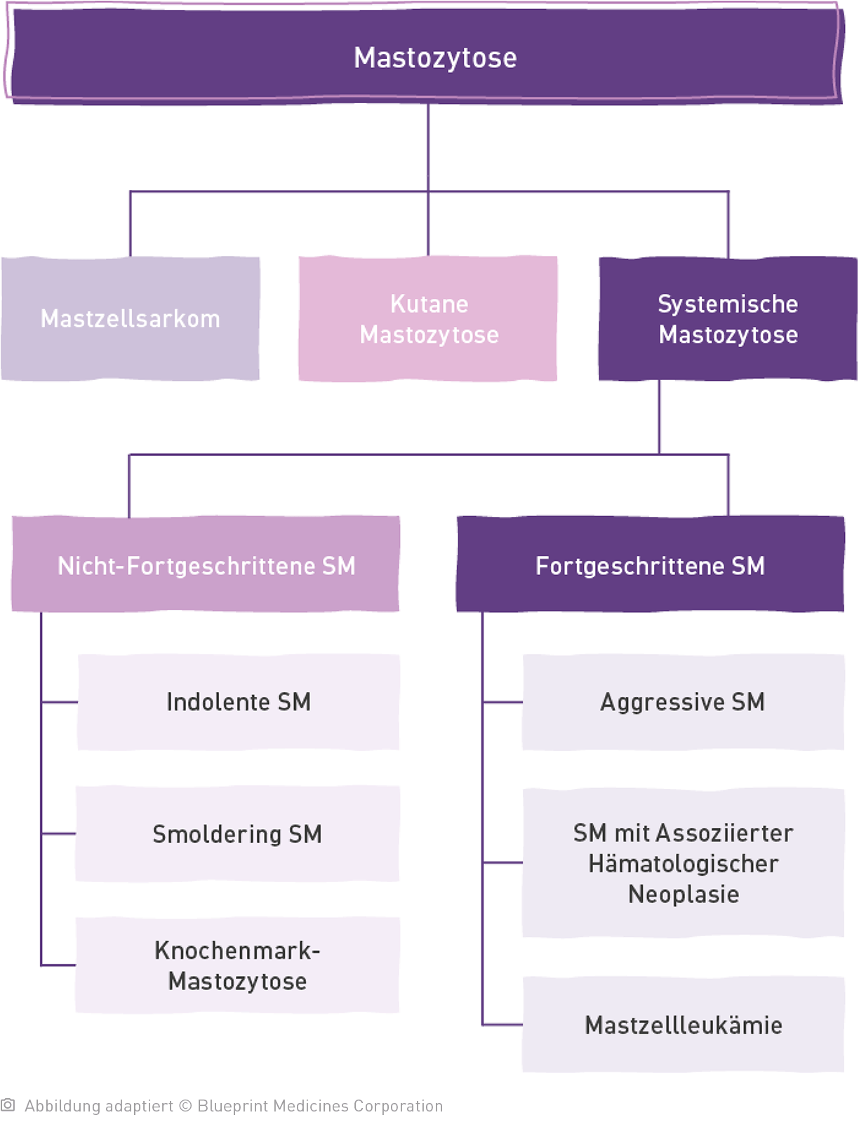 Baumdiagramm der Mastozytose unterteilt in Mastzellsarkom, Kutane Mastozytose und Systemische Mastozytose. Mit einer weiteren Unterteilung der Systemischen Mastozytose in Nicht-Fortgeschrittene SM und Fortgeschrittene SM.